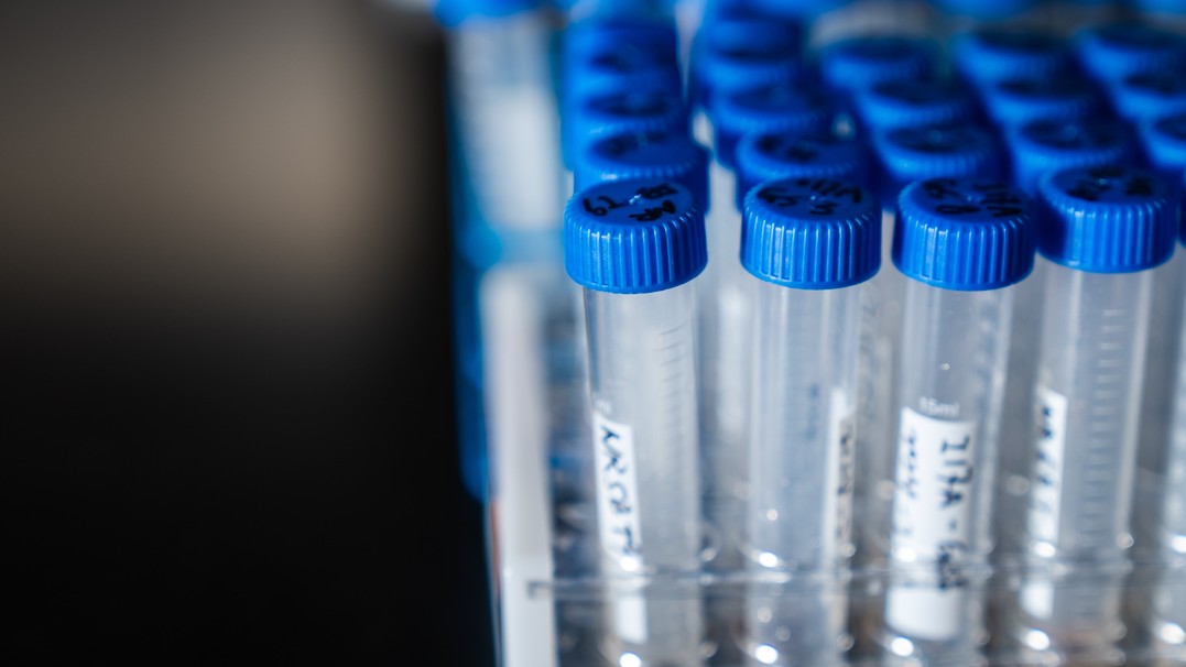 Photo of a collection of vials from a research lab at the University of Arizona 
